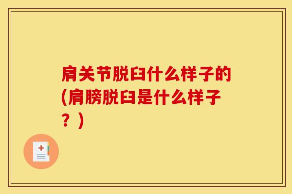 肩关节脱臼什么样子的(肩膀脱臼是什么样子?)-第1张图片-氨糖科普网 肩关节脱臼什么样子的(肩膀脱臼是什么样子?)-第1张图片-氨糖科普网