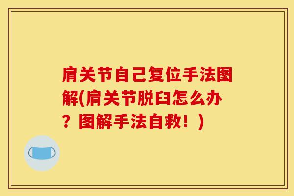 肩关节自己复位手法图解(肩关节脱臼怎么办?图解手法自救!)-第1张图片-氨糖科普网 肩关节自己复位手法图解(肩关节脱臼怎么办?图解手法自救!)-第1张图片-氨糖科普网