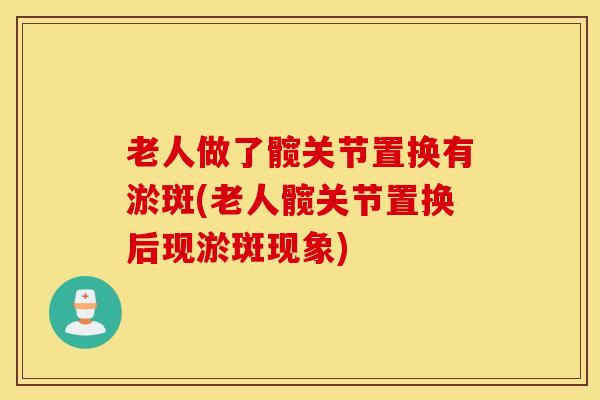 老人做了髋关节置换有淤斑(老人髋关节置换后现淤斑现象)-第1张图片-氨糖科普网 老人做了髋关节置换有淤斑(老人髋关节置换后现淤斑现象)-第1张图片-氨糖科普网