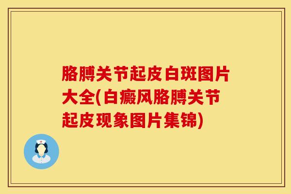 胳膊关节起皮白斑图片大全(白癜风胳膊关节起皮现象图片集锦)-第1张图片-氨糖科普网 胳膊关节起皮白斑图片大全(白癜风胳膊关节起皮现象图片集锦)-第1张图片-氨糖科普网