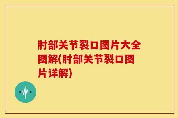 肘部关节裂口图片大全图解(肘部关节裂口图片详解)-第1张图片-氨糖科普网 肘部关节裂口图片大全图解(肘部关节裂口图片详解)-第1张图片-氨糖科普网