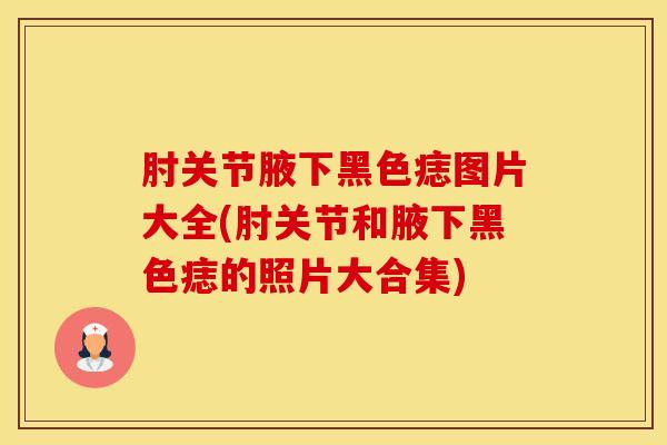 肘关节腋下黑色痣图片大全(肘关节和腋下黑色痣的照片大合集)-第1张图片-氨糖科普网 肘关节腋下黑色痣图片大全(肘关节和腋下黑色痣的照片大合集)-第1张图片-氨糖科普网