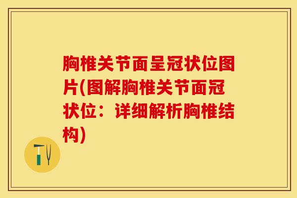 胸椎关节面呈冠状位图片(图解胸椎关节面冠状位:详细解析胸椎结构)-第1张图片-氨糖科普网 胸椎关节面呈冠状位图片(图解胸椎关节面冠状位:详细解析胸椎结构)-第1张图片-氨糖科普网