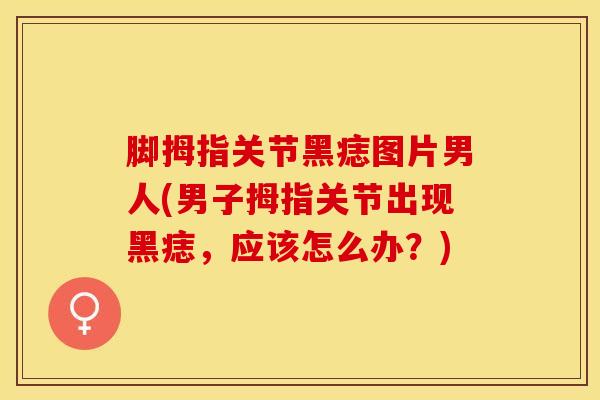 脚拇指关节黑痣图片男人(男子拇指关节出现黑痣,应该怎么办?)-第1张图片-氨糖科普网 脚拇指关节黑痣图片男人(男子拇指关节出现黑痣,应该怎么办?)-第1张图片-氨糖科普网