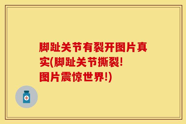 脚趾关节有裂开图片真实(脚趾关节撕裂! 图片震惊世界!)-第1张图片-氨糖科普网 脚趾关节有裂开图片真实(脚趾关节撕裂! 图片震惊世界!)-第1张图片-氨糖科普网