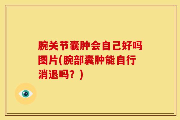 腕关节囊肿会自己好吗图片(腕部囊肿能自行消退吗？)-第1张图片-氨糖科普网