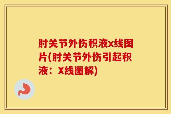 肘关节外伤积液x线图片(肘关节外伤引起积液：X线图解)-第1张图片-氨糖科普网