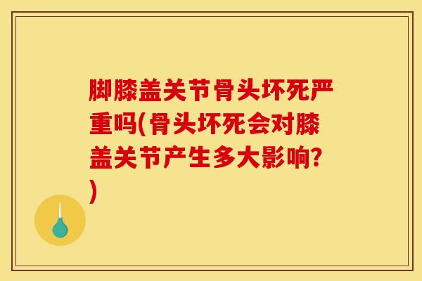 脚膝盖关节骨头坏死严重吗(骨头坏死会对膝盖关节产生多大影响?)-第1张图片-氨糖科普网 脚膝盖关节骨头坏死严重吗(骨头坏死会对膝盖关节产生多大影响?)-第1张图片-氨糖科普网