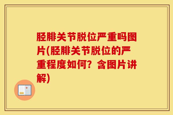 胫腓关节脱位严重吗图片(胫腓关节脱位的严重程度如何？含图片讲解)-第1张图片-氨糖科普网