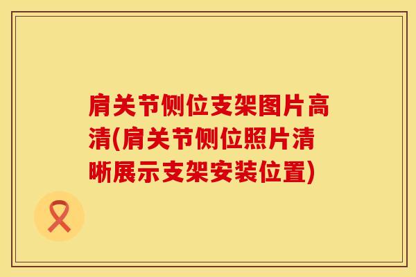 肩关节侧位支架图片高清(肩关节侧位照片清晰展示支架安装位置)-第1张图片-氨糖科普网 肩关节侧位支架图片高清(肩关节侧位照片清晰展示支架安装位置)-第1张图片-氨糖科普网