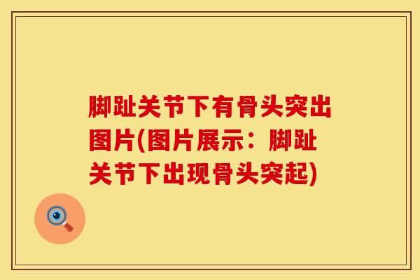 脚趾关节下有骨头突出图片(图片展示:脚趾关节下出现骨头突起)-第1张图片-氨糖科普网 脚趾关节下有骨头突出图片(图片展示:脚趾关节下出现骨头突起)-第1张图片-氨糖科普网