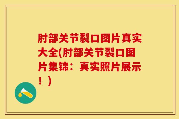 肘部关节裂口图片真实大全(肘部关节裂口图片集锦:真实照片展示!)-第1张图片-氨糖科普网 肘部关节裂口图片真实大全(肘部关节裂口图片集锦:真实照片展示!)-第1张图片-氨糖科普网