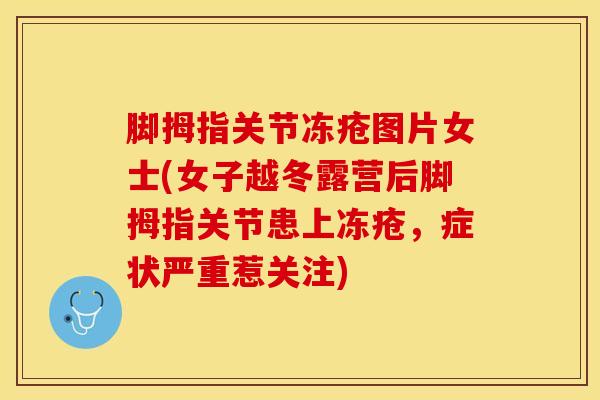 脚拇指关节冻疮图片女士(女子越冬露营后脚拇指关节患上冻疮,症状严重惹关注)-第1张图片-氨糖科普网 脚拇指关节冻疮图片女士(女子越冬露营后脚拇指关节患上冻疮,症状严重惹关注)-第1张图片-氨糖科普网