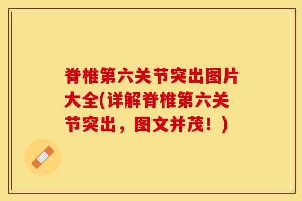 脊椎第六关节突出图片大全(详解脊椎第六关节突出,图文并茂!)-第1张图片-氨糖科普网 脊椎第六关节突出图片大全(详解脊椎第六关节突出,图文并茂!)-第1张图片-氨糖科普网