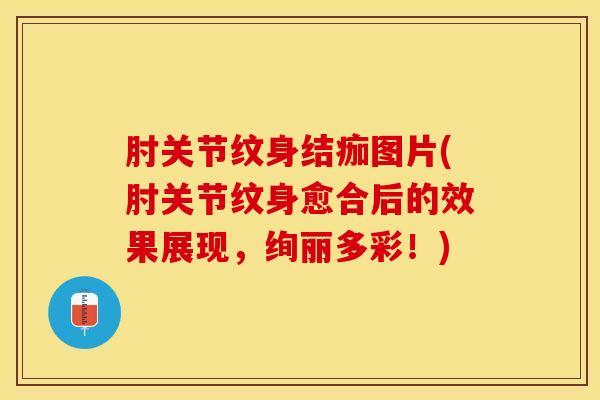 肘关节纹身结痂图片(肘关节纹身愈合后的效果展现,绚丽多彩!)-第1张图片-氨糖科普网 肘关节纹身结痂图片(肘关节纹身愈合后的效果展现,绚丽多彩!)-第1张图片-氨糖科普网
