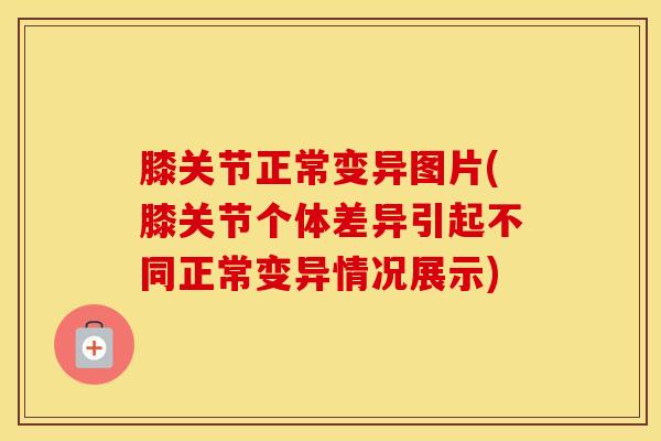 膝关节正常变异图片(膝关节个体差异引起不同正常变异情况展示)-第1张图片-氨糖科普网