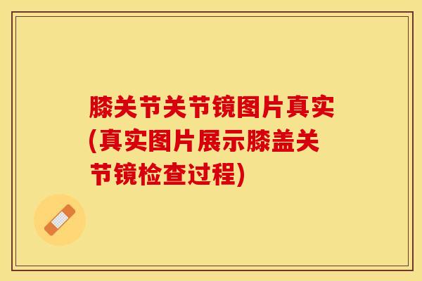 膝关节关节镜图片真实(真实图片展示膝盖关节镜检查过程)-第1张图片-氨糖科普网 膝关节关节镜图片真实(真实图片展示膝盖关节镜检查过程)-第1张图片-氨糖科普网