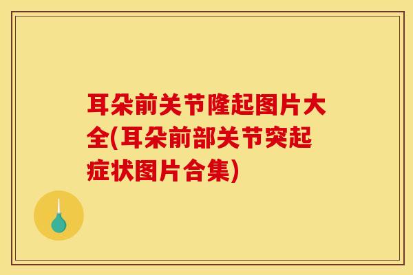 耳朵前关节隆起图片大全(耳朵前部关节突起症状图片合集)-第1张图片-氨糖科普网
