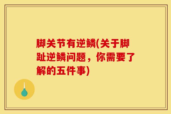 脚关节有逆鳞(关于脚趾逆鳞问题,你需要了解的五件事)-第1张图片-氨糖科普网 脚关节有逆鳞(关于脚趾逆鳞问题,你需要了解的五件事)-第1张图片-氨糖科普网