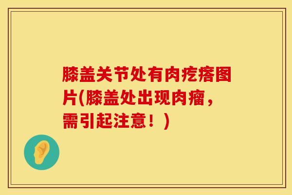 膝盖关节处有肉疙瘩图片(膝盖处出现肉瘤,需引起注意!)-第1张图片-氨糖科普网 膝盖关节处有肉疙瘩图片(膝盖处出现肉瘤,需引起注意!)-第1张图片-氨糖科普网
