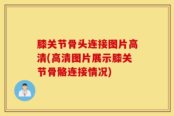 膝关节骨头连接图片高清(高清图片展示膝关节骨骼连接情况)-第1张图片-氨糖科普网 膝关节骨头连接图片高清(高清图片展示膝关节骨骼连接情况)-第1张图片-氨糖科普网