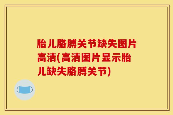 胎儿胳膊关节缺失图片高清(高清图片显示胎儿缺失胳膊关节)-第1张图片-氨糖科普网 胎儿胳膊关节缺失图片高清(高清图片显示胎儿缺失胳膊关节)-第1张图片-氨糖科普网