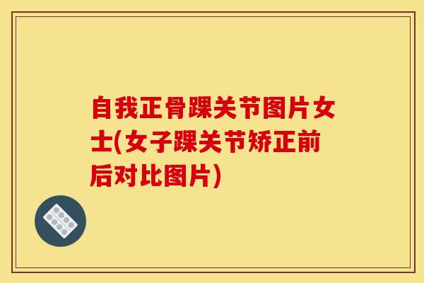 自我正骨踝关节图片女士(女子踝关节矫正前后对比图片)-第1张图片-氨糖科普网 自我正骨踝关节图片女士(女子踝关节矫正前后对比图片)-第1张图片-氨糖科普网
