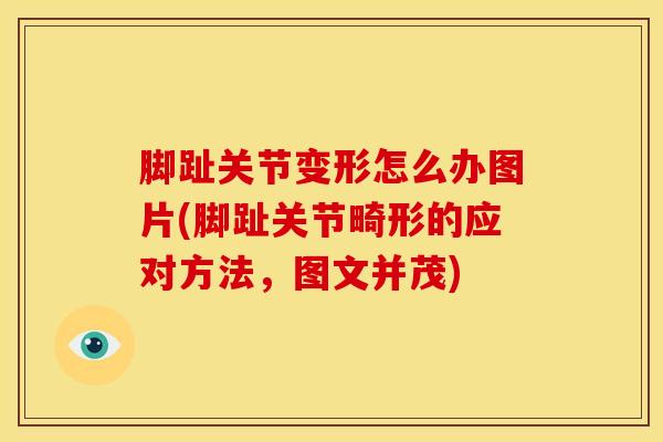 脚趾关节变形怎么办图片(脚趾关节畸形的应对方法，图文并茂)-第1张图片-氨糖科普网