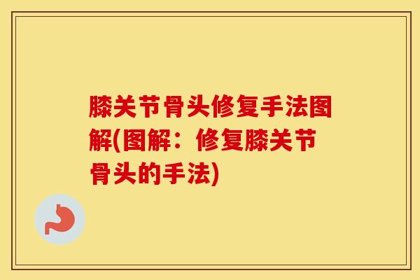 膝关节骨头修复手法图解(图解：修复膝关节骨头的手法)-第1张图片-氨糖科普网