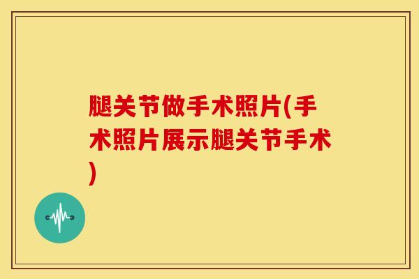 腿关节做手术照片(手术照片展示腿关节手术)-第1张图片-氨糖科普网 腿关节做手术照片(手术照片展示腿关节手术)-第1张图片-氨糖科普网