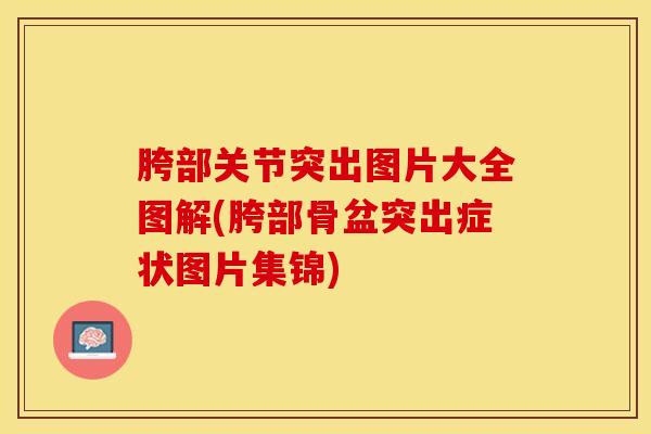胯部关节突出图片大全图解(胯部骨盆突出症状图片集锦)-第1张图片-氨糖科普网 胯部关节突出图片大全图解(胯部骨盆突出症状图片集锦)-第1张图片-氨糖科普网