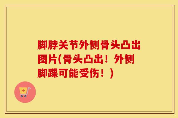 脚脖关节外侧骨头凸出图片(骨头凸出!外侧脚踝可能受伤!)-第1张图片-氨糖科普网 脚脖关节外侧骨头凸出图片(骨头凸出!外侧脚踝可能受伤!)-第1张图片-氨糖科普网