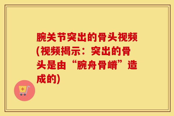 腕关节突出的骨头视频(视频揭示：突出的骨头是由“腕舟骨嵴”造成的)-第1张图片-氨糖科普网