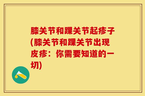 膝关节和踝关节起疹子(膝关节和踝关节出现皮疹:你需要知道的一切)-第1张图片-氨糖科普网 膝关节和踝关节起疹子(膝关节和踝关节出现皮疹:你需要知道的一切)-第1张图片-氨糖科普网