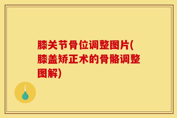 膝关节骨位调整图片(膝盖矫正术的骨骼调整图解)-第1张图片-氨糖科普网 膝关节骨位调整图片(膝盖矫正术的骨骼调整图解)-第1张图片-氨糖科普网