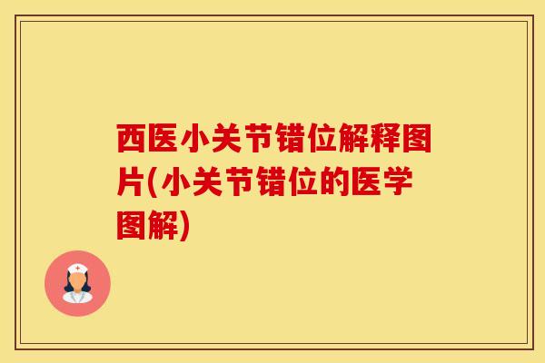 西医小关节错位解释图片(小关节错位的医学图解)-第1张图片-氨糖科普网
