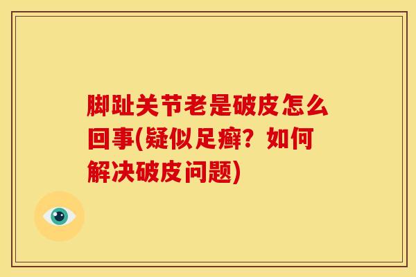 脚趾关节老是破皮怎么回事(疑似足癣?如何解决破皮问题)-第1张图片-氨糖科普网 脚趾关节老是破皮怎么回事(疑似足癣?如何解决破皮问题)-第1张图片-氨糖科普网