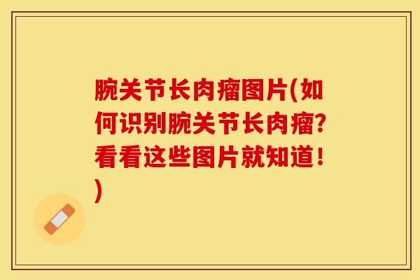 腕关节长肉瘤图片(如何识别腕关节长肉瘤?看看这些图片就知道!)-第1张图片-氨糖科普网 腕关节长肉瘤图片(如何识别腕关节长肉瘤?看看这些图片就知道!)-第1张图片-氨糖科普网