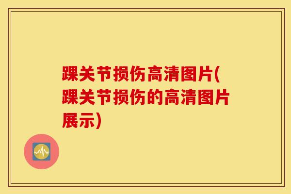 踝关节损伤高清图片(踝关节损伤的高清图片展示)-第1张图片-氨糖科普网 踝关节损伤高清图片(踝关节损伤的高清图片展示)-第1张图片-氨糖科普网