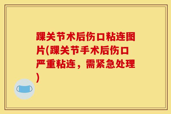 踝关节术后伤口粘连图片(踝关节手术后伤口严重粘连,需紧急处理)-第1张图片-氨糖科普网 踝关节术后伤口粘连图片(踝关节手术后伤口严重粘连,需紧急处理)-第1张图片-氨糖科普网