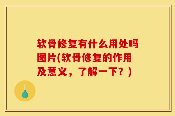 软骨修复有什么用处吗图片(软骨修复的作用及意义,了解一下?)-第1张图片-氨糖科普网 软骨修复有什么用处吗图片(软骨修复的作用及意义,了解一下?)-第1张图片-氨糖科普网