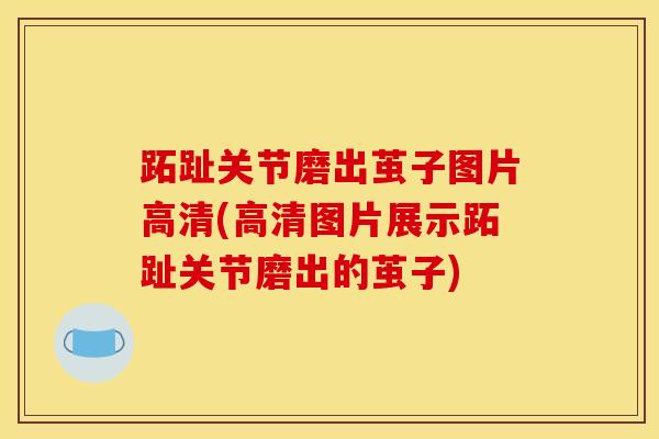 跖趾关节磨出茧子图片高清(高清图片展示跖趾关节磨出的茧子)-第1张图片-氨糖科普网