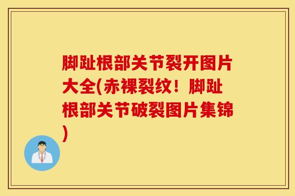 脚趾根部关节裂开图片大全(赤裸裂纹！脚趾根部关节破裂图片集锦)-第1张图片-氨糖科普网