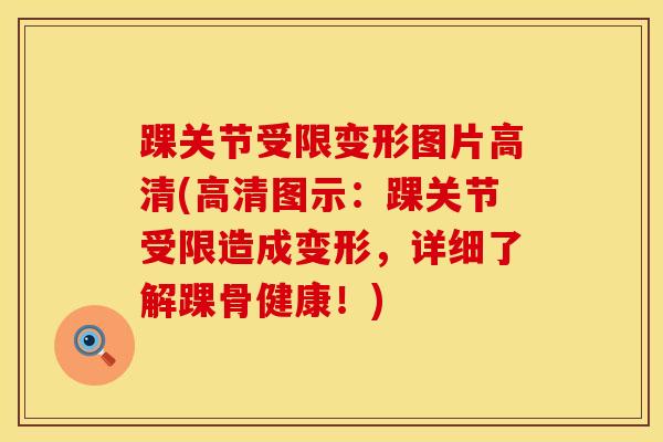踝关节受限变形图片高清(高清图示：踝关节受限造成变形，详细了解踝骨健康！)-第1张图片-氨糖科普网