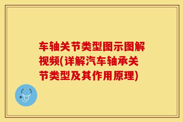 车轴关节类型图示图解视频(详解汽车轴承关节类型及其作用原理)-第1张图片-氨糖科普网 车轴关节类型图示图解视频(详解汽车轴承关节类型及其作用原理)-第1张图片-氨糖科普网
