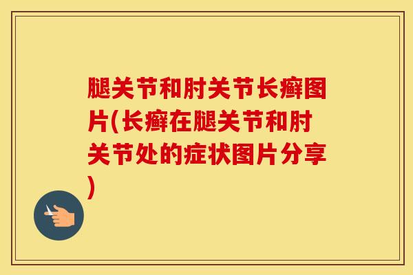 腿关节和肘关节长癣图片(长癣在腿关节和肘关节处的症状图片分享)-第1张图片-氨糖科普网