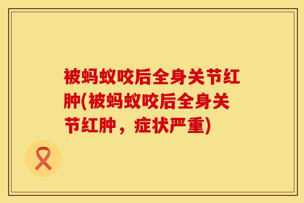 被蚂蚁咬后全身关节红肿(被蚂蚁咬后全身关节红肿,症状严重)-第1张图片-氨糖科普网 被蚂蚁咬后全身关节红肿(被蚂蚁咬后全身关节红肿,症状严重)-第1张图片-氨糖科普网