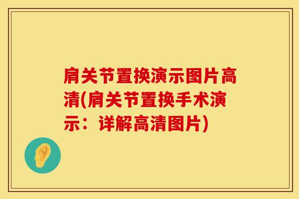 肩关节置换演示图片高清(肩关节置换手术演示:详解高清图片)-第1张图片-氨糖科普网 肩关节置换演示图片高清(肩关节置换手术演示:详解高清图片)-第1张图片-氨糖科普网