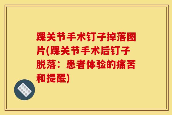踝关节手术钉子掉落图片(踝关节手术后钉子脱落:患者体验的痛苦和提醒)-第1张图片-氨糖科普网 踝关节手术钉子掉落图片(踝关节手术后钉子脱落:患者体验的痛苦和提醒)-第1张图片-氨糖科普网
